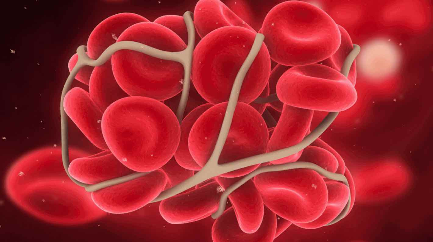 HEMOSTASIA 